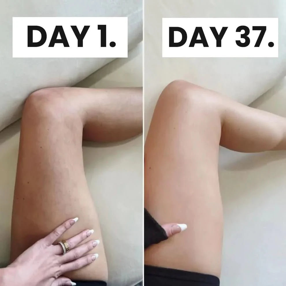 Glorace™ Cellulite Relief Kit